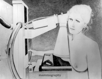 mammography