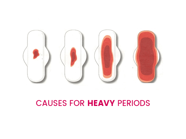 How Much Blood Flow During Periods He Or She May Ask You Questions 